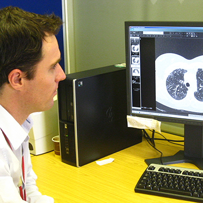 Interstitial Lung Disease