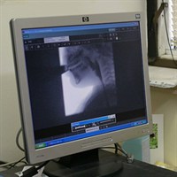 Videofluoroscopy